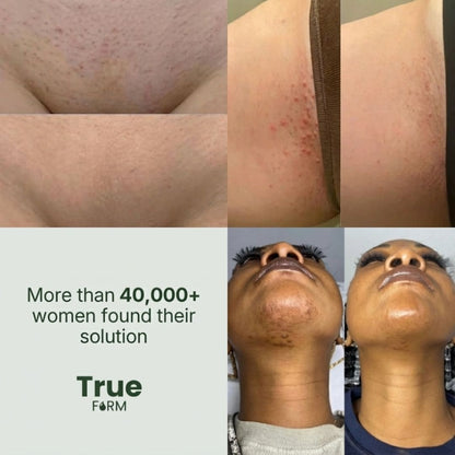 Cyperus Rotundus Hair Serum