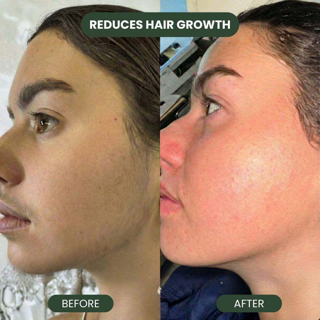 Cyperus Rotundus Hair Serum