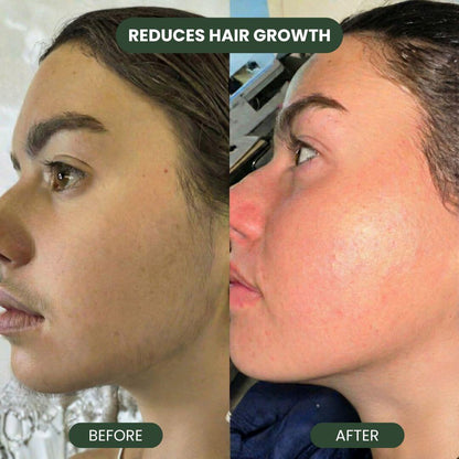 Cyperus Rotundus Hair Serum