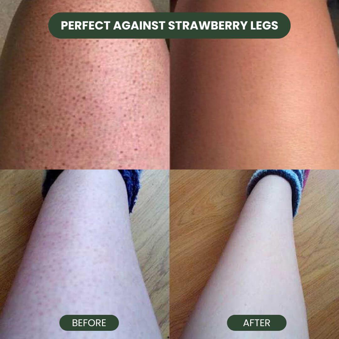 Cyperus Rotundus Hair Serum