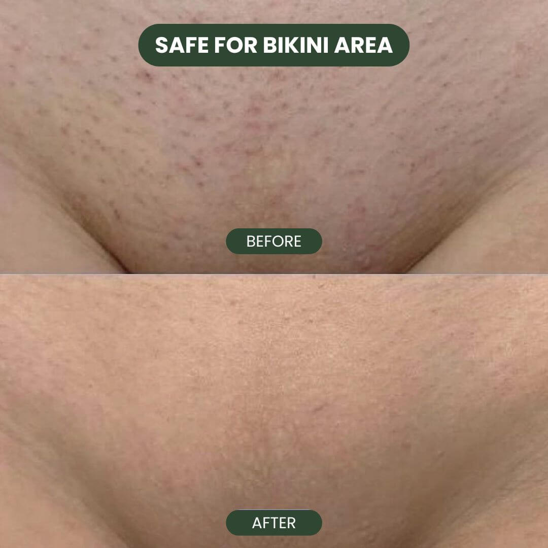 Cyperus Rotundus Hair Serum