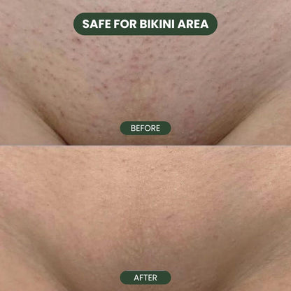 Cyperus Rotundus Hair Serum